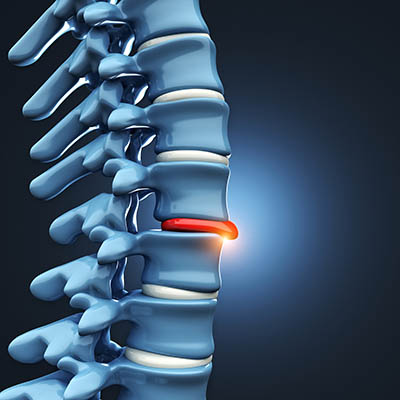 spine injuries